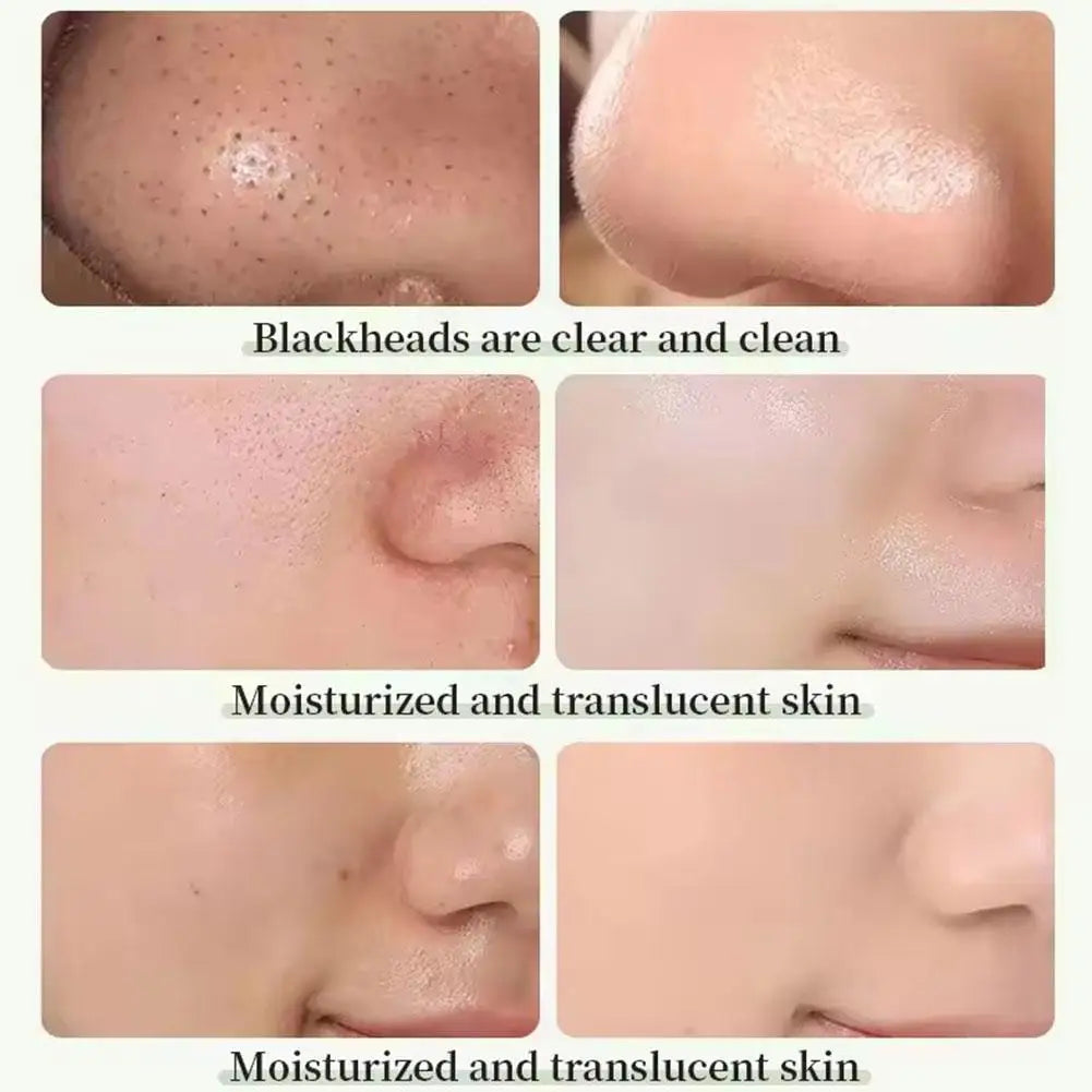 2024 NEW Green Tea Solid Cleansing Mask Dispel Acne Remover Moisturizing Film Mask Blackhead Pores Smear Cleansing Blemish O1Y7